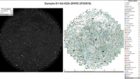 AP23485052 &ndash; Түпкі кенорындар кендерінде, құм шашылымдарында және оларды қайта өңдеу өнімдеріңдегі жұқа және наноөлшемді алтынды зерттеу әдістемесін әзірлеу