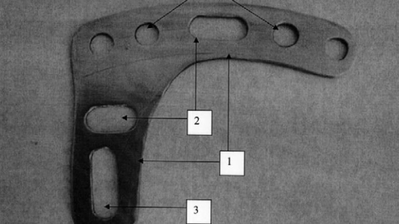 AP26199207 &ndash; Остеосинтезге арналған жекелендірілген және бірыңғай пластиналардың биоинженерлік цифрлық дизайн және инновациялық өндіру